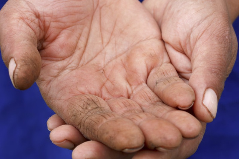 Needy-hands-3p-810x385 Cropped